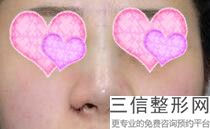2022年上海长鼻矫正整形医院榜单前三!上海真美妇科医院公立对比全国私立连锁