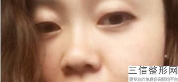 2022年上海眼综合整形医院三大排名！上海万丽医疗美容门诊部公立私立实力相当
