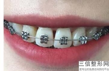 2022年上海腰部抽脂美容整形医院排名！上海福曦口腔门诊口碑不错