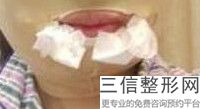 2022年上海伊维兰注射丰唇术整容医院前三名！上海美之源整形外科医院名闻遐迩