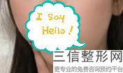 2022年上海伊维兰注射丰唇整形医院排行榜！上海韩镜医疗美容医院领衔前三甲_内有价格明细表