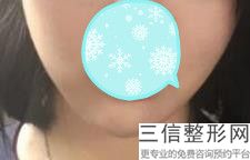 2022年上海阴唇肥大手术医院怎么选择？上海诺迪新天地医疗美容权威加有名各占一半