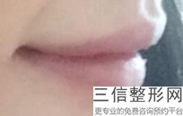 2022年上海长久去唇毛美容整形医院哪家好？上海星璨门诊部分享排名前四口碑！