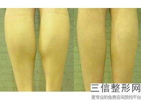 2022年上海针灸丰胸整形美容医院排名!上海安平医院含新价格表收费标准