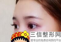 2022年上海针灸去眼袋整形医院选择？上海医院入围前三甲~名次查询