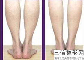 2022年上海注射玻尿酸丰胸整形医院！上海首尔丽格医疗美容医院私立医美3强口碑擅长各不同