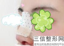 2022年上海注射除鼻背纹整形医院排行榜！上海光博士医疗美容门诊部一起来看看哪些牛？