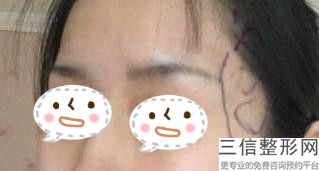 2022年上海注射胶原蛋白丰唇美容医院前三！上海仁生医疗美容门诊部医美5强实力口碑盘点，附价格