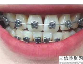 2022年上海注射肉毒素去动态纹医院怎么选择？上海恒愿口腔门诊部名不虚传