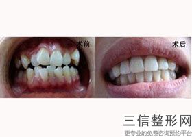 2022年上海自然文眉整形医院三大排名！上海拜博博尔口腔名满天下