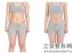 2022年上海自体干细胞丰胸整形医院哪家好？上海曙光医院医疗美容科等凭实力拔得头筹！
