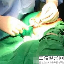 2022年上海自体脂肪丰耳垂整容医院排名！上海瑞阳整形外科门诊部稳居口碑前三