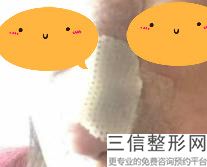 2022年天津胶原蛋白注射隆鼻术美容医院前三！天津塘沽汉诚医学美容诊所凭好口碑稳稳上前三强~
