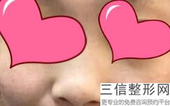 2022年天津胶原蛋白注射隆鼻整形医院排行榜!天津市非常好中心医院烧伤整形科2022美容价格表在线查询
