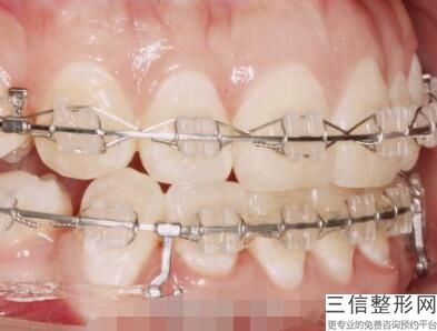 2022年天津洁牙美容整形排行榜！天津伊美尔医疗整形美容专科医院口碑良好