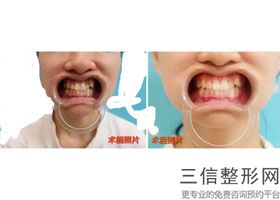 2022年天津洁牙整形医院有哪些?天津丽人医院医美三强口碑擅长各不同