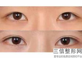 2022年天津近视眼矫正整形医院！天津文怡医疗美容医院位列前三