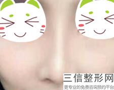 2022年天津酒渣鼻治疗美容整形医院排名！天津医科大学总医院整形外科领衔~公立私立口碑盘点