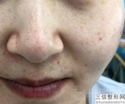 2022年天津开眼睑整形医院排行榜！天津市长征医院皮肤科蒸蒸日上