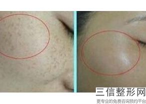 2022年天津烤瓷牙修复整形医院前三！天津市中医药研究院附属医院皮肤外科名列前茅