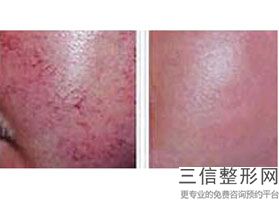2022年天津拉皮除皱手术整形医院如何选择？天津文怡医疗美容医院整形价格表