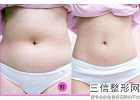 2022年天津冷冻溶脂瘦手臂整形医院哪里有?天津欧菲整形美容医院名闻遐迩