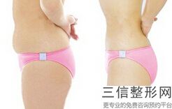 2022年天津冷冻溶脂瘦腰腹整形医院有哪些？天津美莱医学美容医院赫赫有名