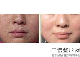 2022年天津脸部拉皮整形医院榜单！天津伊美尔医疗整形美容专科医院2022私立医美机构价格费用免费一查