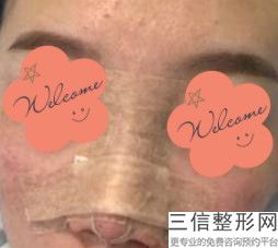 2022年天津隆鼻整形医院排名前三！天津市第四医院烧伤整形科排行榜前四私立领衔!