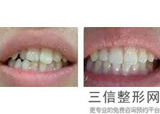 2022年天津漏斗胸整形医院排名！天津市口腔医院整形外科私立知名好评医院当选