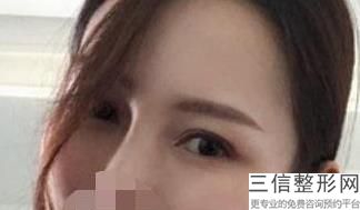 2022年天津眉弓去薄术整容医院榜单！天津圣韩美医学美容门诊部稳居口碑前三