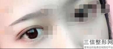 2022年天津眉弓填充整容整形医院排行榜！天津艺姿蔓医疗美容医院实力出众