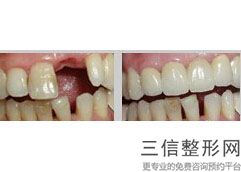 2022年天津眉毛移植术整形医院三大排名！天津市口腔医院整形外科大名鼎鼎