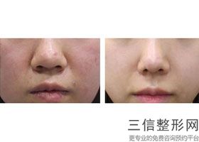 2022年天津美白针整形医院排名！天津博莱美医疗美容门诊实力超强