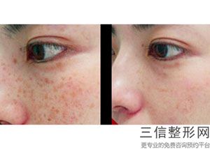 2022年天津内眦赘皮切除整容医院榜单！天津文怡医疗美容医院权威加有名各占一半