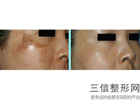 2022年天津女性生殖外形矫正整容医院排名！天津市中医药研究院附属医院皮肤外科等上榜！附价格表！