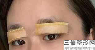 2022年天津欧式芭比全切双眼皮美容医院前三！天津丽人医院看谁更胜一筹