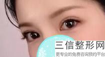 2022年天津欧式双眼皮整形医院有哪些？天津缪慈医疗美容门诊部拔山盖世