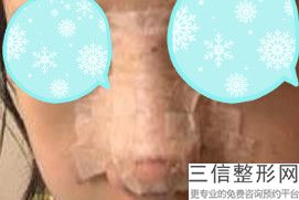 2022年天津膨体垫鼻基底整形医院榜单！天津艺姿蔓医疗美容医院实力不俗_看私立口碑点评