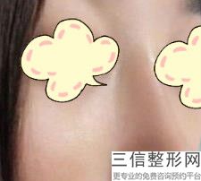 2022年天津膨体隆鼻整形医院哪里有？天津市中医药研究院附属医院皮肤外科大名鼎鼎