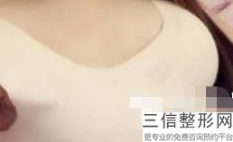 2022年天津膨体隆胸整容医院前三位！天津丽人医院排行榜前五强权威汇总盘点！