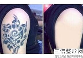 2022年天津皮肤缝合法鼻小柱延长整容医院前三位！天津市中医药研究院附属医院皮肤外科2022价格表清单透明！