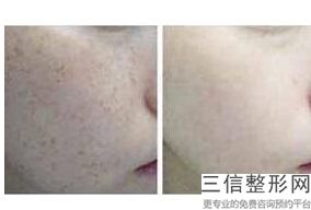 2022年天津皮肤扩张美容医院前三！天津欧菲整形美容医院等凭实力拔得头筹！