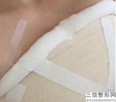 上海PIP隆胸假体整容的价格高吗(2022年09月PIP隆胸假体均价为：4564元)