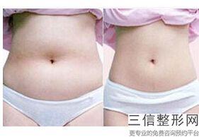 上海botox瘦小腿美容的价格盘点(2022年09月botox瘦小腿均价为：4659元)