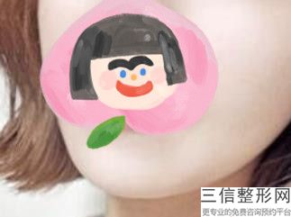 上海爱贝芙注射丰唇整形一般要多少钱一次(2022年09月爱贝芙注射丰唇均价为：4572元)