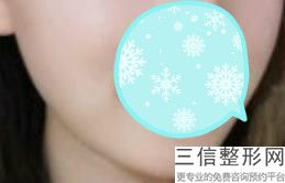 上海爱笑唇整容平均价格(2022年09月爱笑唇均价为：4418元)