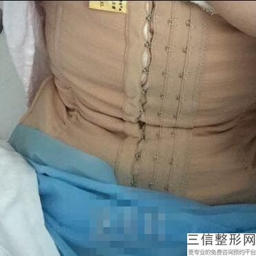 上海按摩丰乳整形价格标准(2022年09月按摩丰乳均价为:4590元)