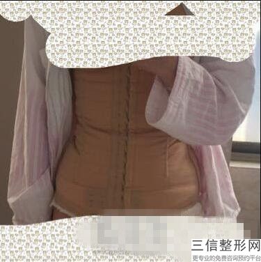 上海按摩紧致美容具体价格参考(2022年09月按摩紧致均价为：4603元)
