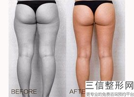 上海按摩去眼袋美容费用是怎样的(2022年09月按摩去眼袋均价为：4469元)